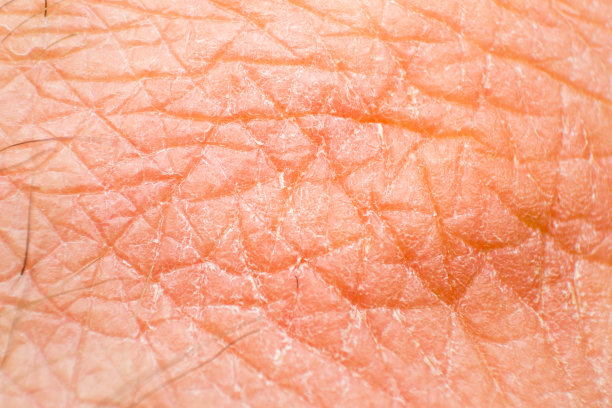 经常用肥皂洗手后皮肤干燥的微距照片图片下载