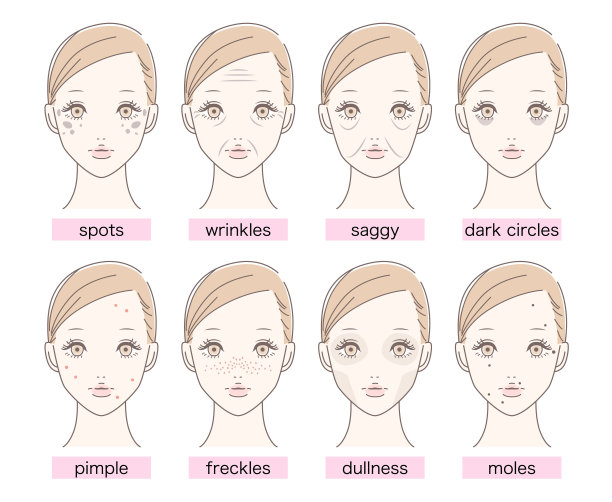 漂亮的女人，有斑点，皱纹，下垂，黑眼圈，粉刺，雀斑，呆滞，痣。孤立在白色的。图片下载
