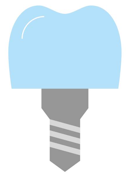 钻牙插图图片下载