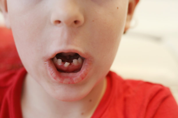 小男孩松了，牙齿歪了图片下载