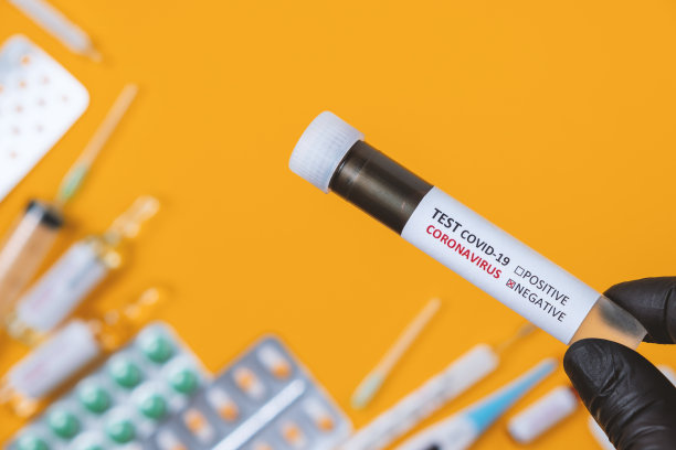 负COVID-19测试。护士手持装有实验室血液样本的试管进行新型冠状病毒检测诊断分析，概念。新冠肺炎，概念照片图片下载