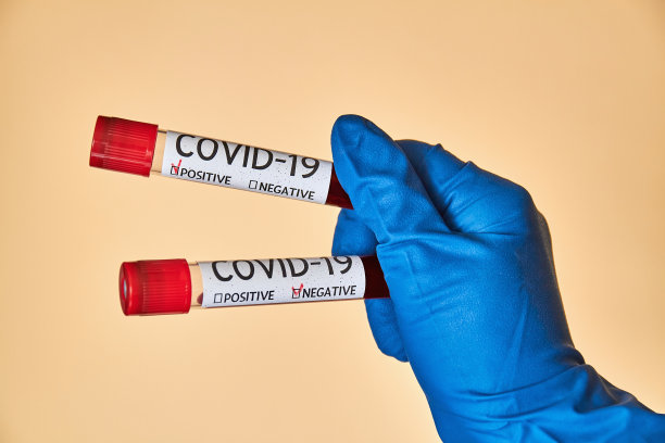 概念上的照片。手拿血液样本，检测冠状病毒管中是否存在血液样本。积极和消极的结果。实验室检测病人血液。图片下载