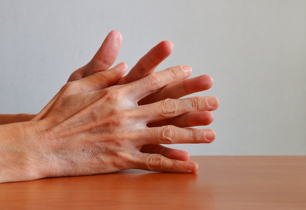 经常洗手导致皮肤干燥图片下载