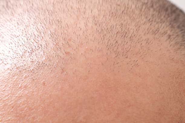 细头发的特写图像图片下载