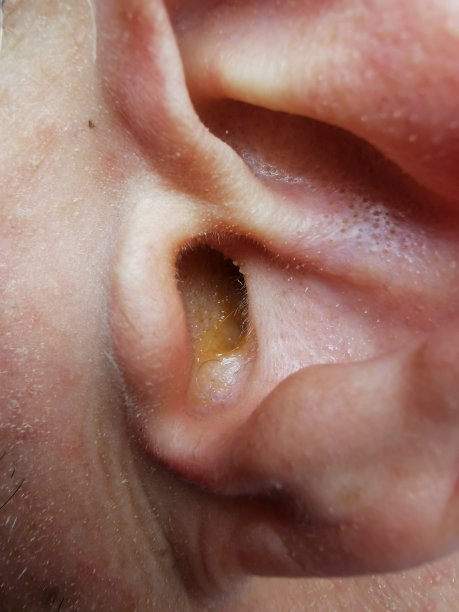 奥伦施马尔茨素材图片