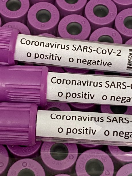 3支包装上带有紫色盖子的冠状病毒肺炎- cov -2型Covid-19试管，试管数量较多图片下载