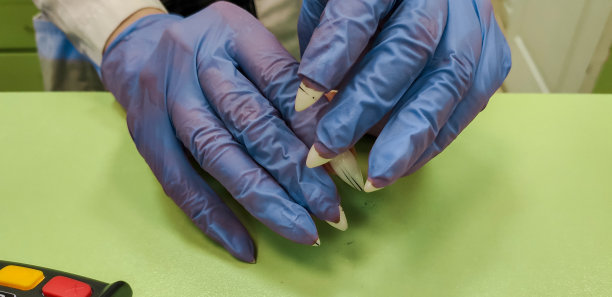 隔离2019冠状病毒病美甲女性的问题。售货员的手套破了。指甲手套撕裂。图片下载