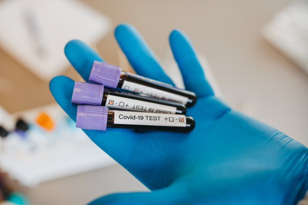 手上拿着检测COVID-19 -冠状病毒阳性和阴性血液样本的试管素材图片