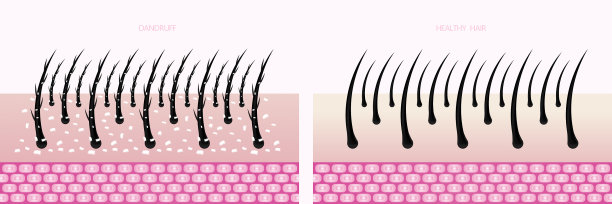 护发技术图片下载