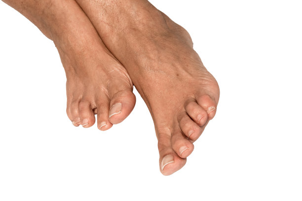 一个白人成年女子的脚，背景是白色。图片下载