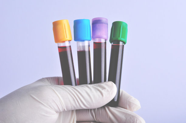 手上拿着一个装有血液样本测试的试管。实验室检测病人。图片下载