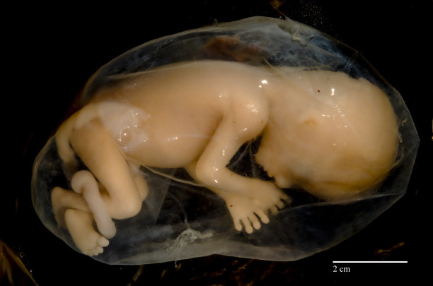 胎儿在羊膜囊图片下载