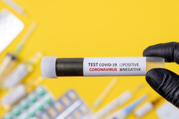 负COVID-19测试。护士手持装有实验室血液样本的试管进行新型冠状病毒检测诊断分析，概念。新冠肺炎，概念照片图片下载