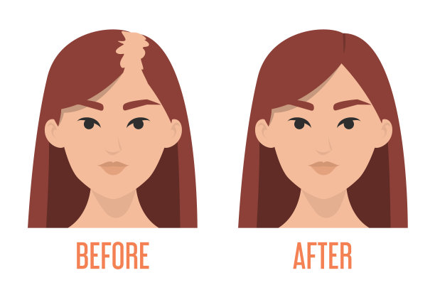 头发移植前后图片下载