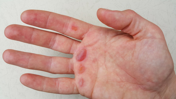 一个工人长满老茧的手掌。图片下载