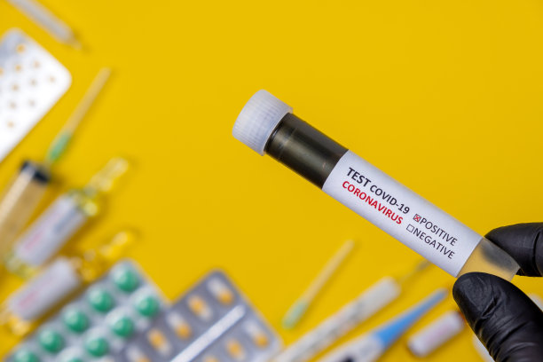 积极COVID-19测试。护士手持装有实验室血液样本的试管进行新型冠状病毒检测诊断分析，概念。新冠肺炎，概念照片图片下载