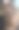 烧伤脚的特写图片下载