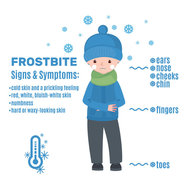 冻伤信息图卡通风格孤立在白色背景。图片下载