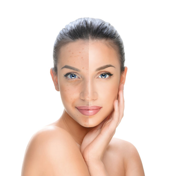 美丽年轻的黑发女子，美丽的概念，坏的条件和完美的条件图片下载