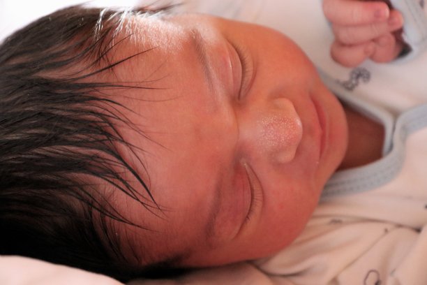 新生儿鼻子上的小白疙瘩图片下载