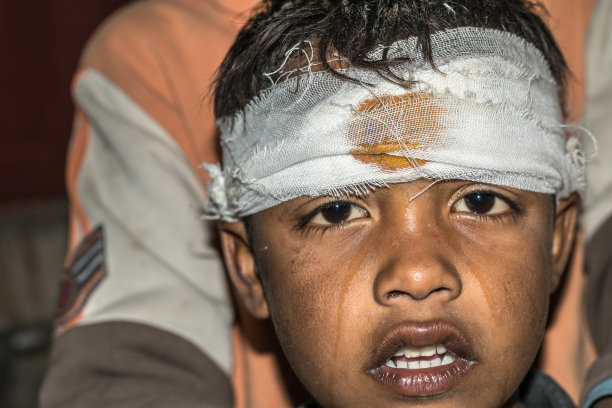 一个白人儿童在运动时照顾受伤的黑人儿童图片下载