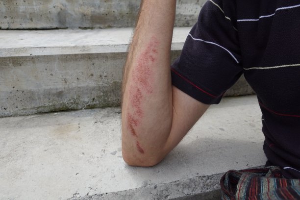 在户外运动中腋下的磨损图片下载