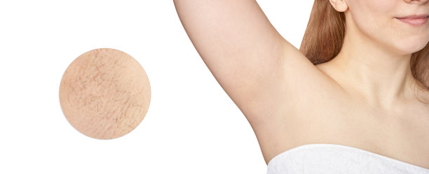 女孩腋下。白人女人腋窝。脱毛前后。图片下载