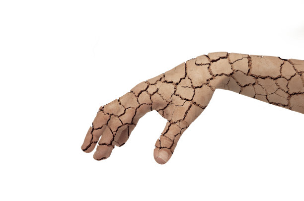 干性皮肤的概念图片下载