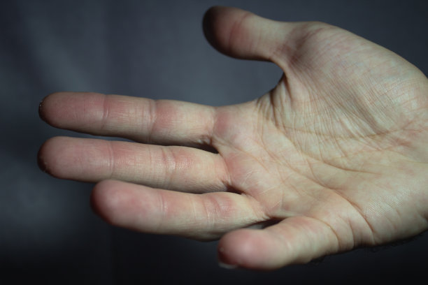 在艰苦的攀岩训练后，手上有小老茧图片下载