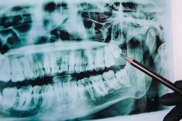 医生检查牙齿x光图像，近距离图片下载