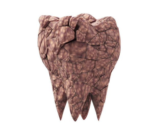 脏牙菌斑破坏臼齿图片下载