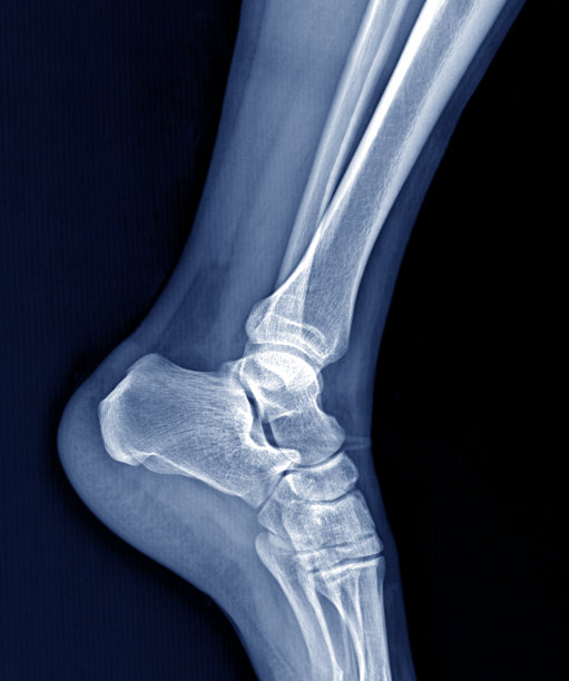 脱节和痛苦的库存照片图片下载