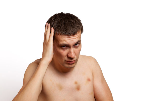 在一家照相馆里，一名有着欧洲人外貌的棕色头发男子赤裸着身体，身上有淤青，他的手放在头上。麻醉广告。图片下载