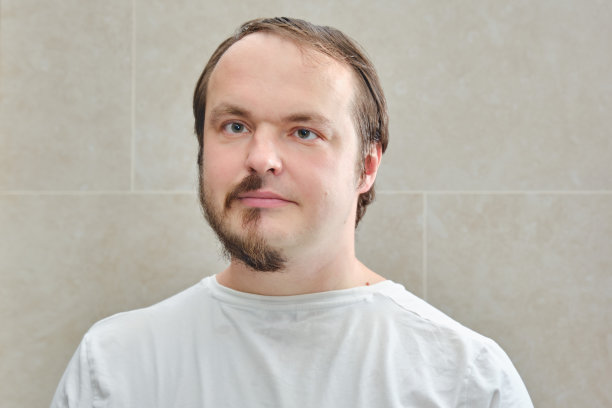 剃须之前和之后。一个留着半胡子的拼贴肖像男。脸人35-40岁。不整洁的外表和问题的概念与冠状病毒大流行隔绝图片下载