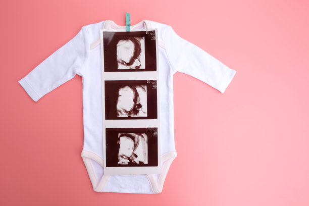 婴儿布与4d超声婴儿和袜子在粉红色的背景。怀孕宣布的概念。图片下载