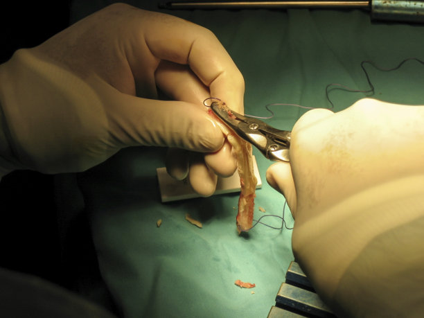 膝关节交叉韧带手术图片下载