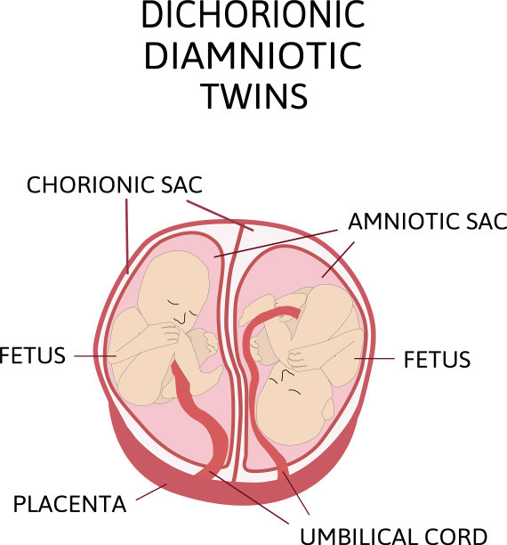 解剖腹部与双胞胎类型图片下载