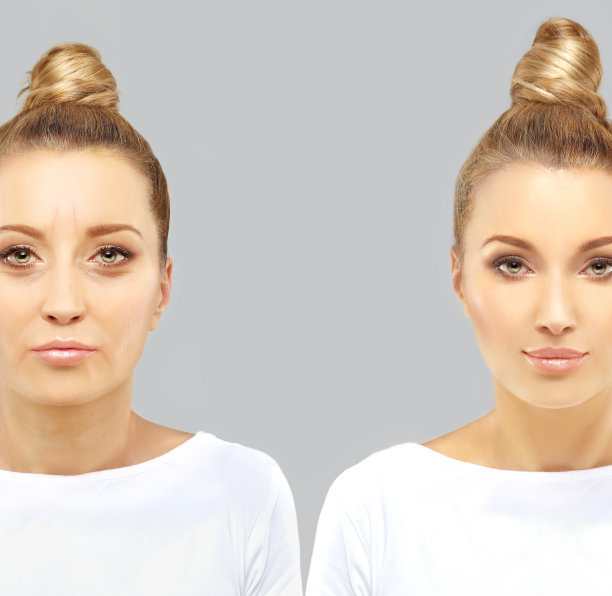 老化。成熟女人年轻的女人。面对皮肤问题。展示前后的照片图片下载