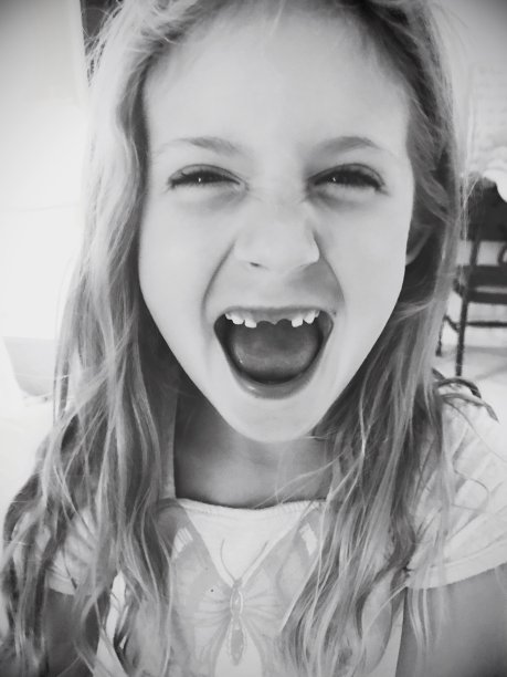 缺门牙的小女孩图片下载