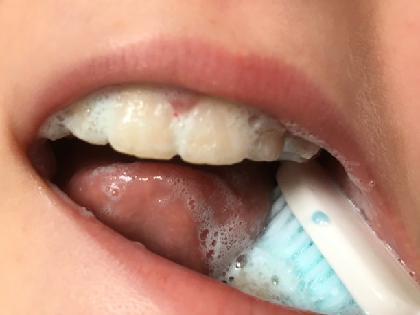 牙齿健康，刷牙和清洁的特写图片下载