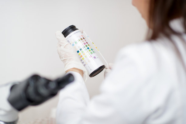 戴上手套，比较尿样试纸和尿样表图片下载