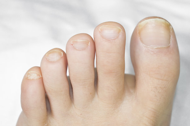 光着脚的女人图片下载