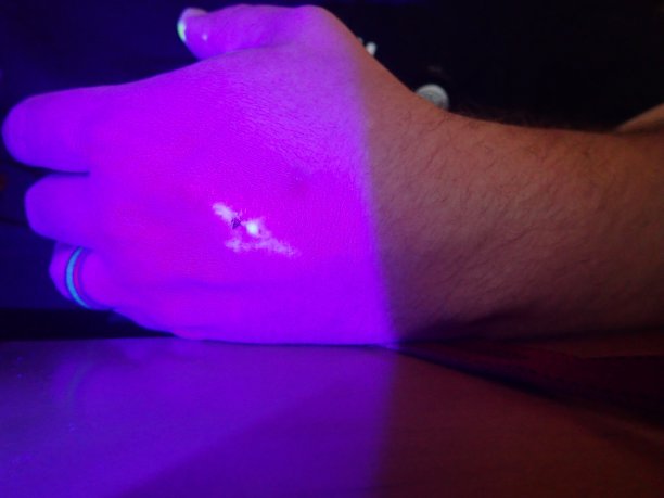 荧光素钠医用用途图片下载