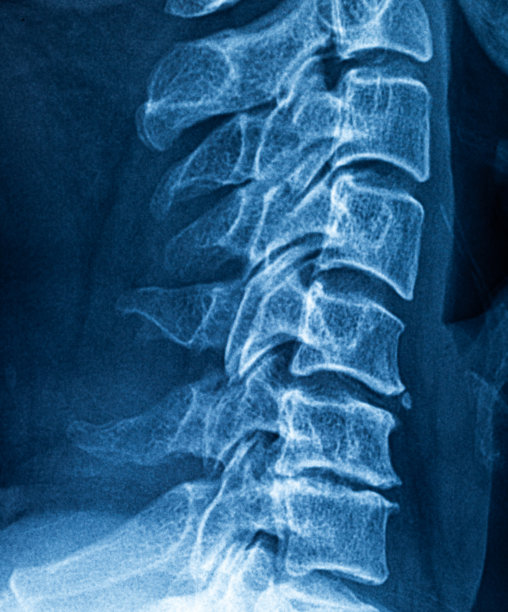 颈部x光片图片下载