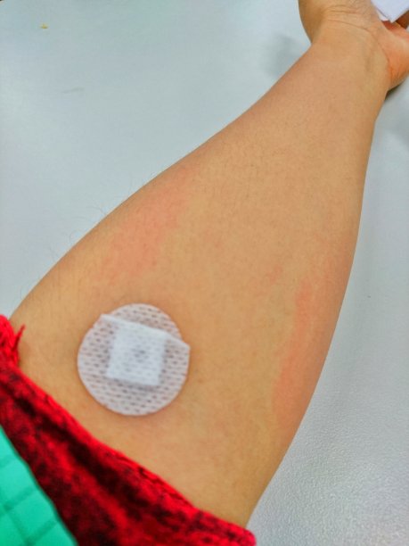 2019年1月31日，印度尼西亚宾坦，捐赠者手中拿着绷带图片下载