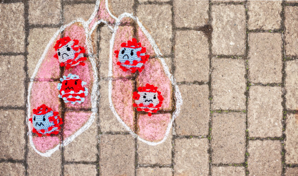 covid-19感染肺部图片下载