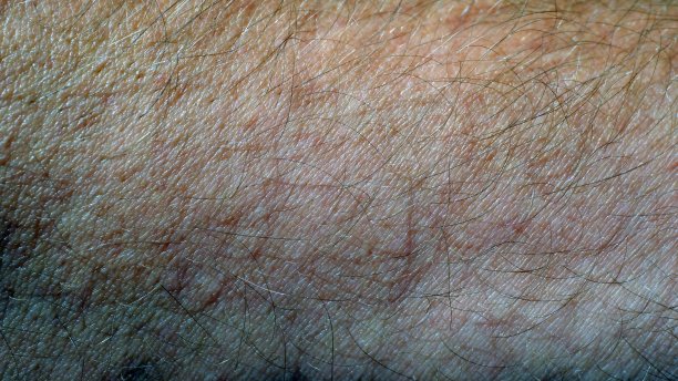 人手上皮肤上的毛发图片下载