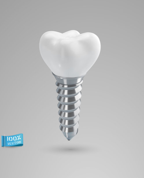 向量现实种植体孤立在灰色背景。为设计元素。图片下载