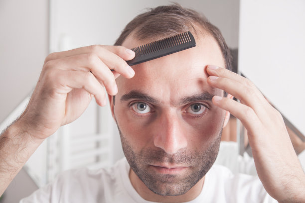 梳头发的白人男子。脱发图片下载