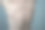 过敏反应是年轻男子身上出现红斑。图片下载